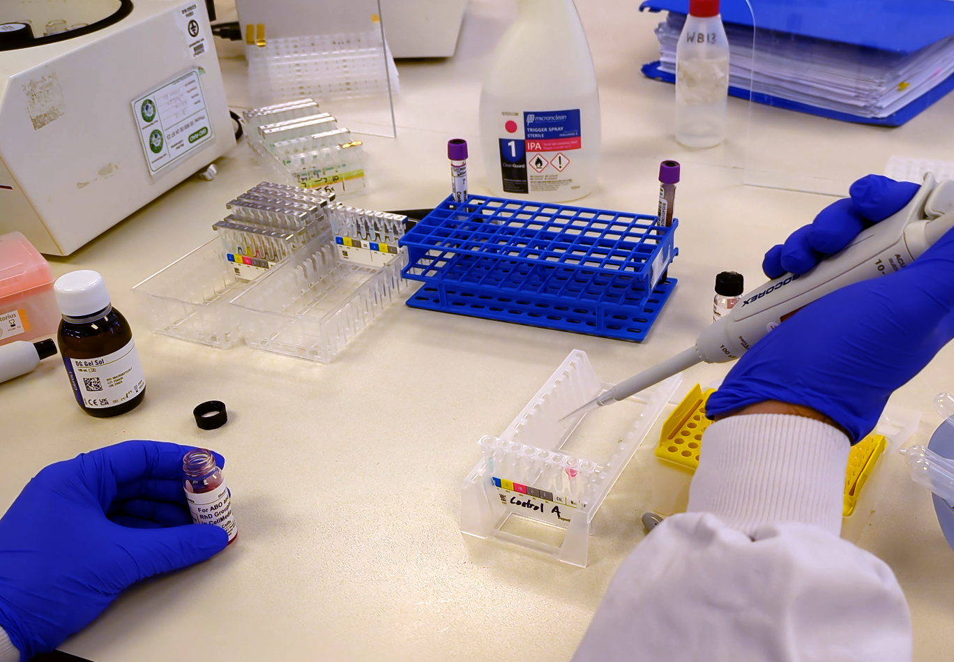Protected: NHSBT ABO Blood Grouping